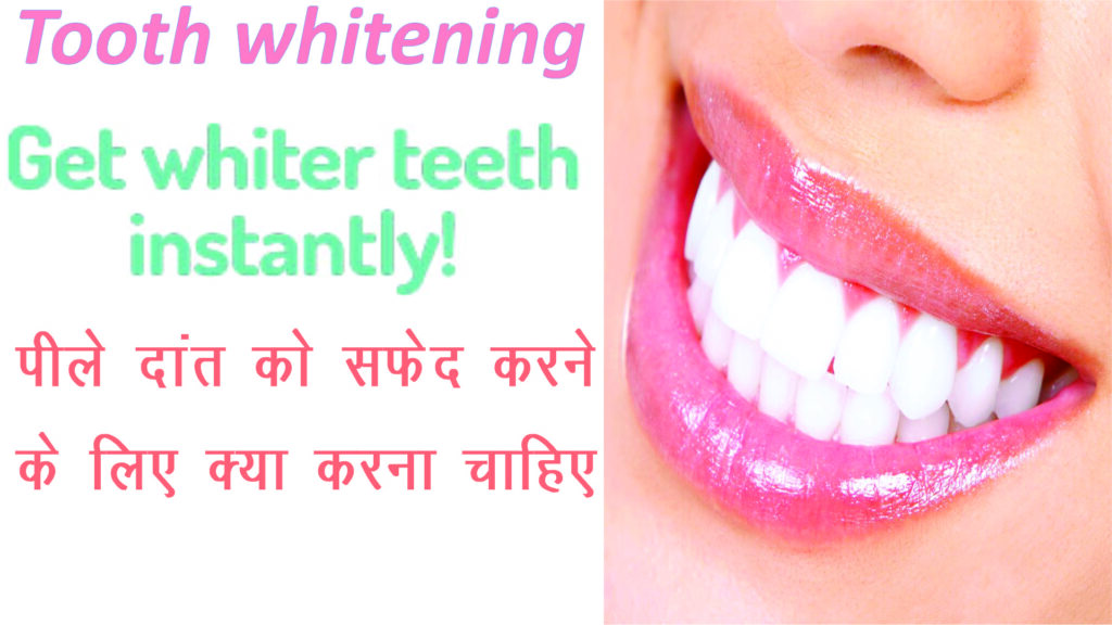 teeth whitening cost in india |tooth whitening treatment |hydrogen peroxide |how to whiten teeth instantly 