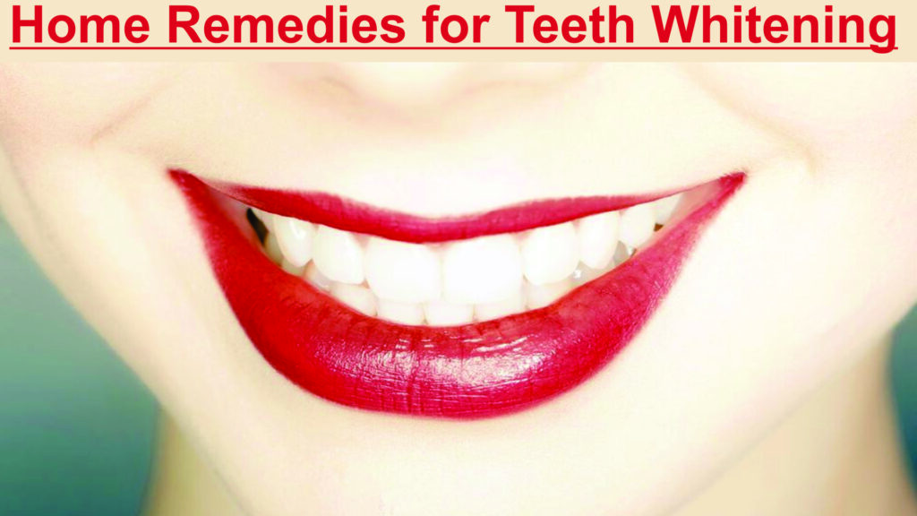 Tooth whitening | how to whiten teeth | what is the best teeth whitening kit in hindi