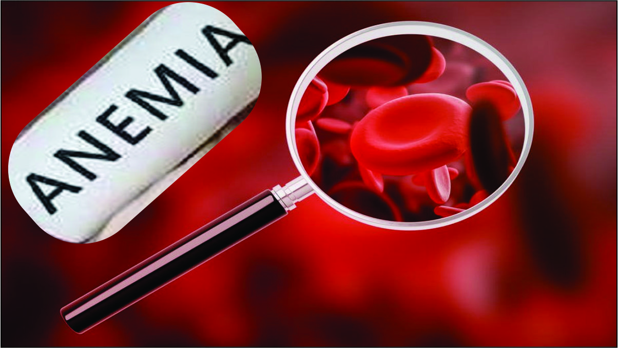 Anemia Symptoms And Treatment Anemia Causes Diagnosis 3650