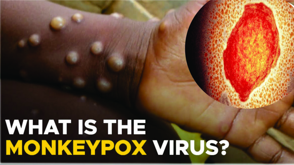monkeypox virus in india what is monkeypox virus